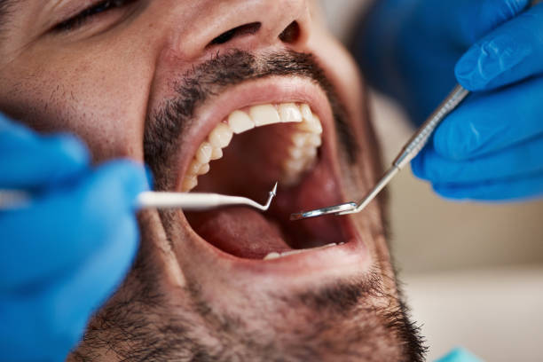 Best TMJ/TMD Treatment  in Clinton, MD