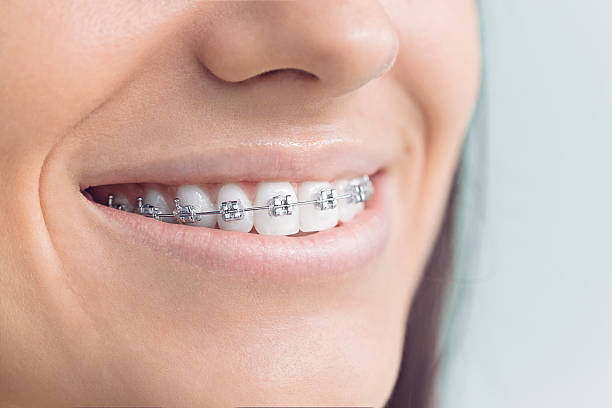 Best Veneers and Lumineers  in Clinton, MD